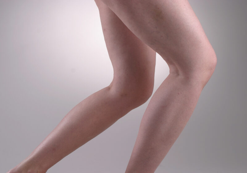 Knie