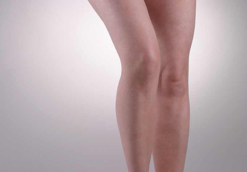 Arthrose