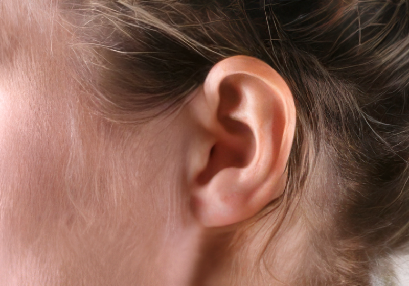 Tinnitus